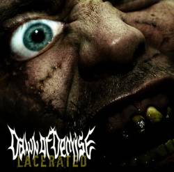 Dawn Of Demise : Lacerated